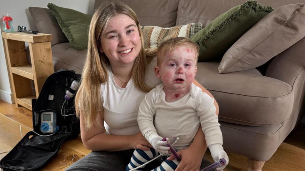 Epidermolysis bullosa: The boy whose skin could tear from a cuddle ...