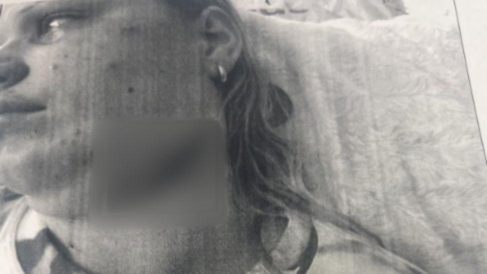 A grainy black and white photograph of Lauren, who appears to be lying down on a pillow. She appears to be crying. The picture has been blurred to obscure a wound to her neck.