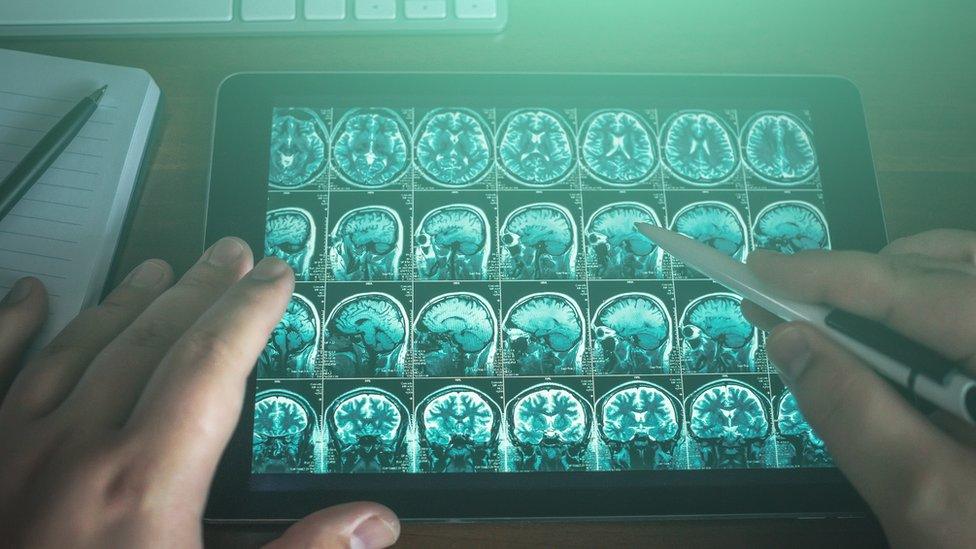 Brain scans displayed on a tablet