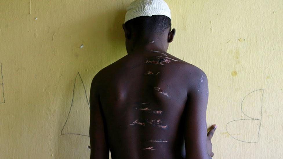 A 15 year-old-boy, one of hundreds of men and boys rescued by police from an institution purporting to be an Islamic school, reveals scars on his back at a transit camp set up to take care of the released captives in Kaduna, Nigeria September 28, 2019.