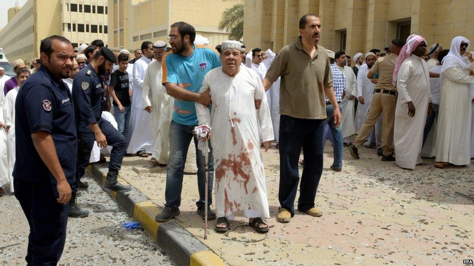 An injured man is helped following a blast at Imam Sadiq Mosque in al-Sawaber, Kuwait City, Kuwait, on 26 June 2015.