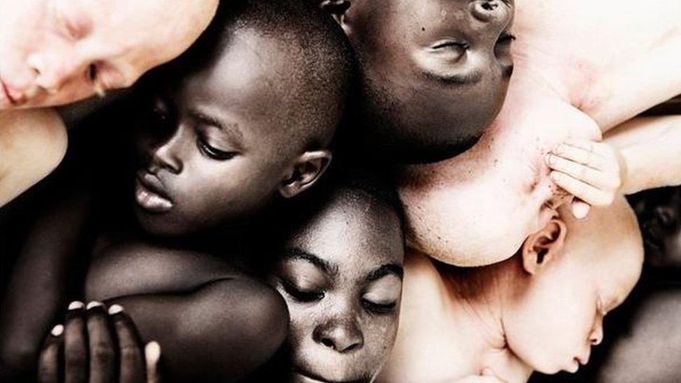 Tweeted photo of albino and black-skinned Africans