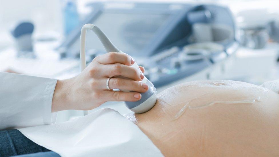 A stock image of a woman having an ultrasound