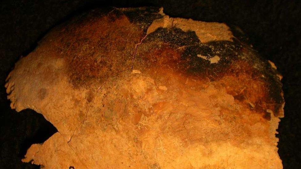 Burned skull part