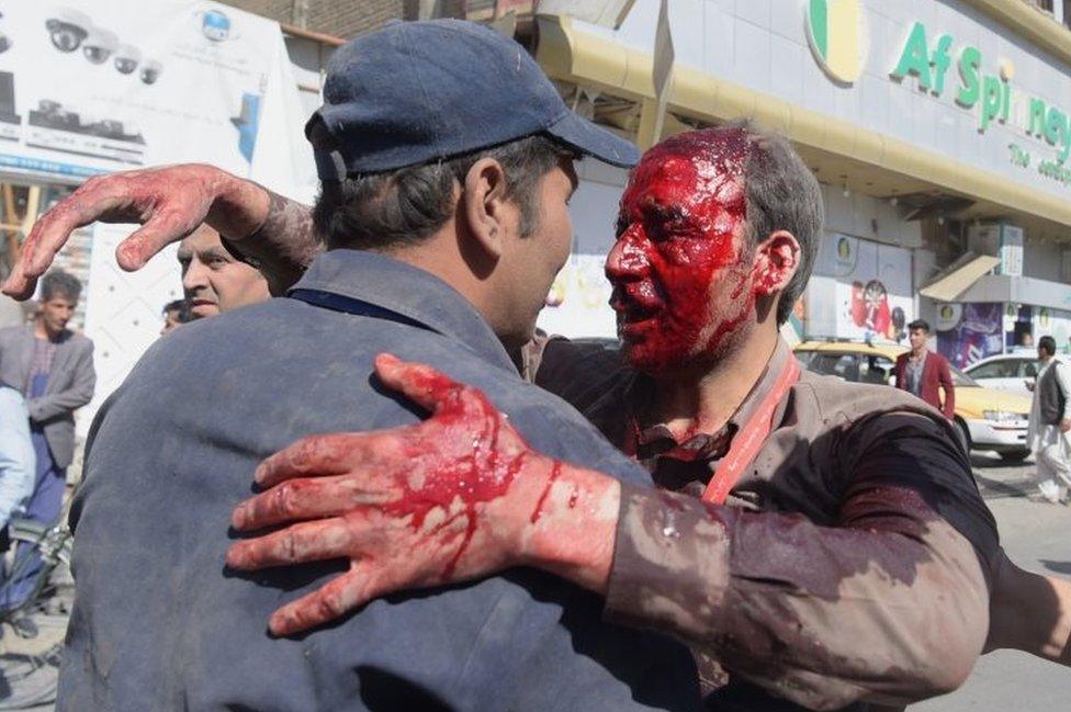 A wounded man receives assistance in Kabul. Photo: 31 May 2017