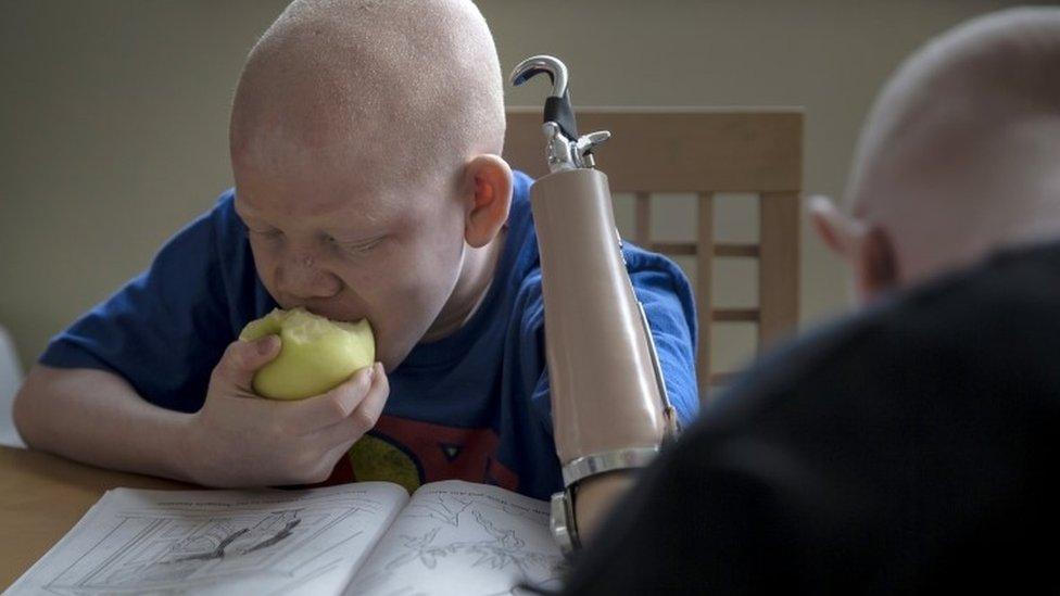 12-year-old Mwigulu Matonage from Tanzania eats an apple as he does homework in the Staten Island borough of New York, September 21, 2015