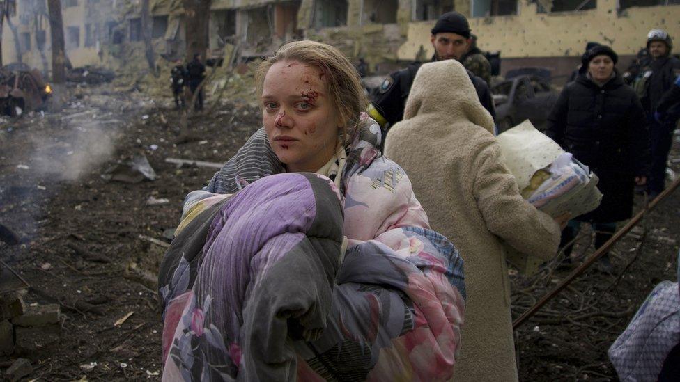 Marianna Vishegirskaya stands outside a maternity hospital that was damaged by shelling in Mariupol, Ukraine, Wednesday, March 9, 2022. Vishegirskaya survived the shelling and later gave birth to a girl in another hospital in Mariupol days later