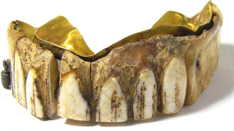 The hippo ivory and gold plated teeth