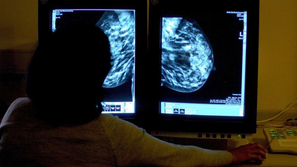 Mammogram