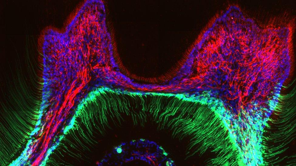 Scan showing the inside of a tooth