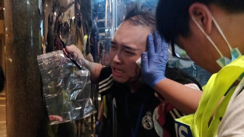 Andrew Chiu Ka Yin, District Councillor of Taikoo Shing West, receives help from first aid volunteers after sustaining an injury in a knife attack at a shopping mall, in Taikoo Shing in Hong Kong, China November 3, 2019.