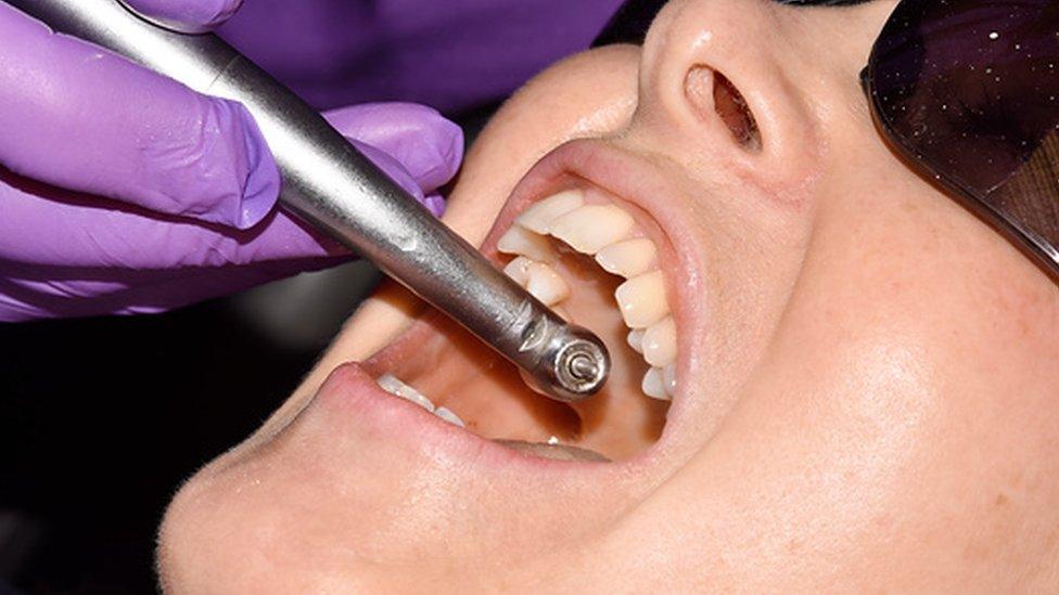 Dental filling