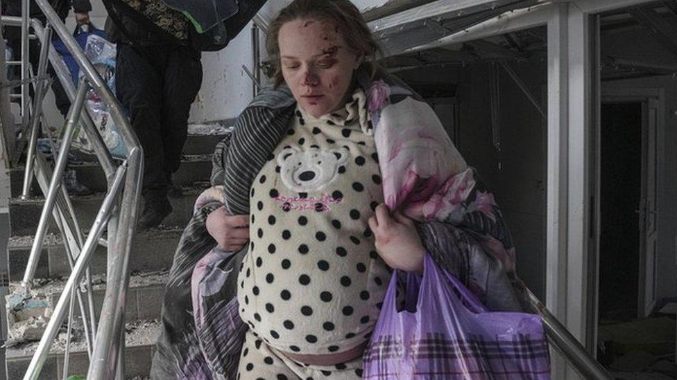 An injured pregnant woman walks downstairs in a maternity hospital damaged by shelling in Mariupol, Ukraine, Wednesday, March 9, 2022