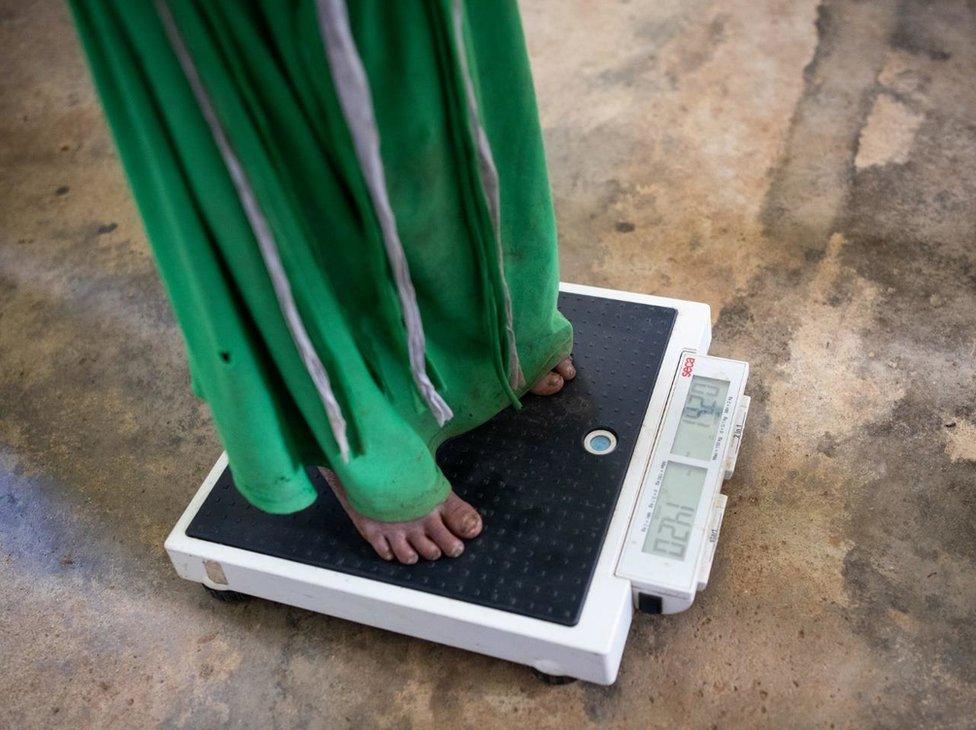 A patient is weighed