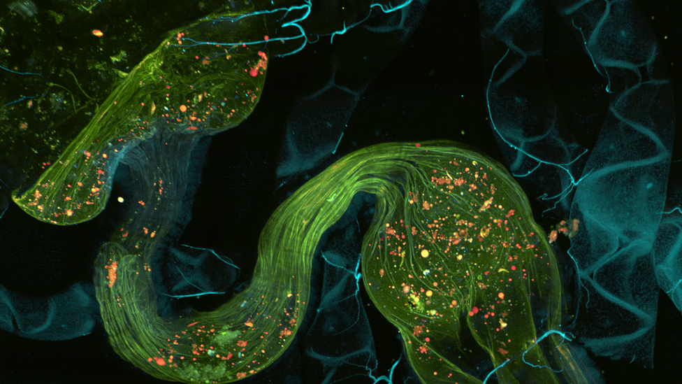 The gut of an Asian tiger mosquito as photographed by an Andor scientific camera