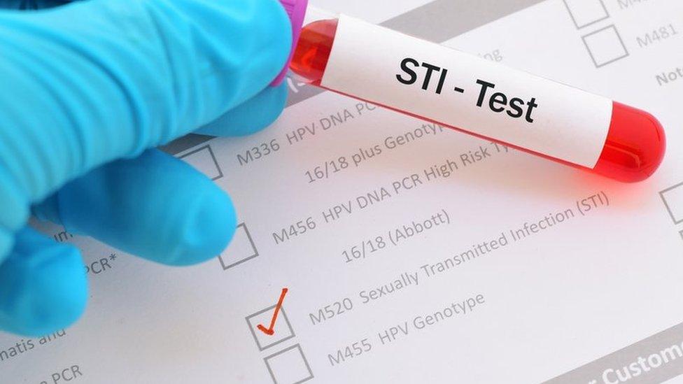 STI test