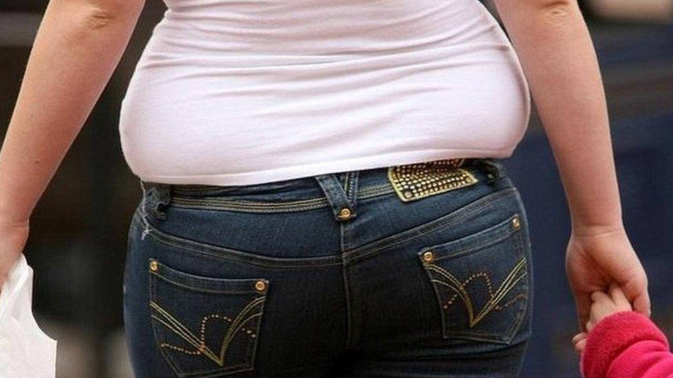 Obese woman pictured from behind