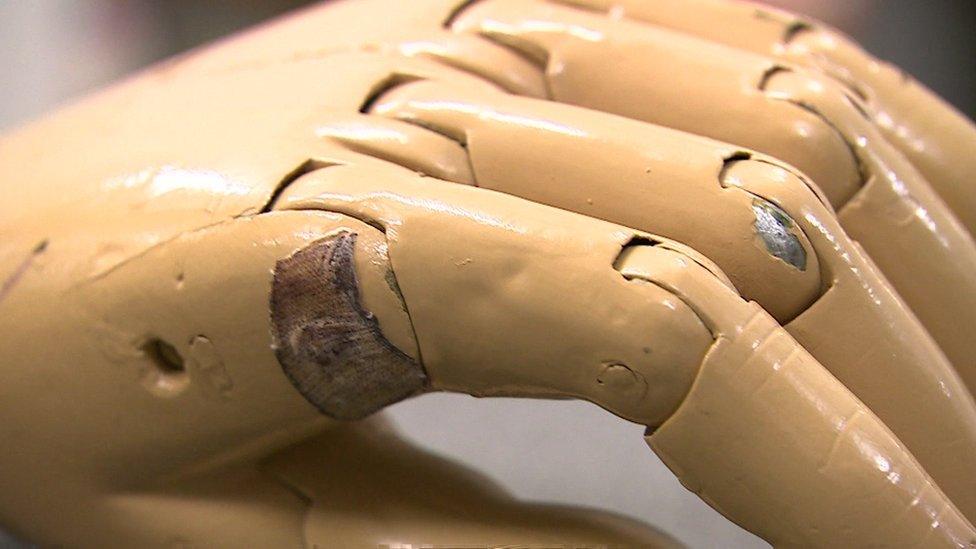 A WW1 era prosthetic hand