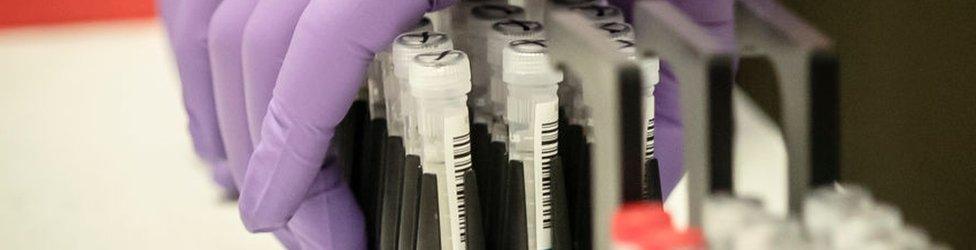 Samples are tested for respiratory viruses during a visit by Chancellor Rishi Sunak to the pathology labs at Leeds General Infirmary on March 12, 2020 in Leeds, England.