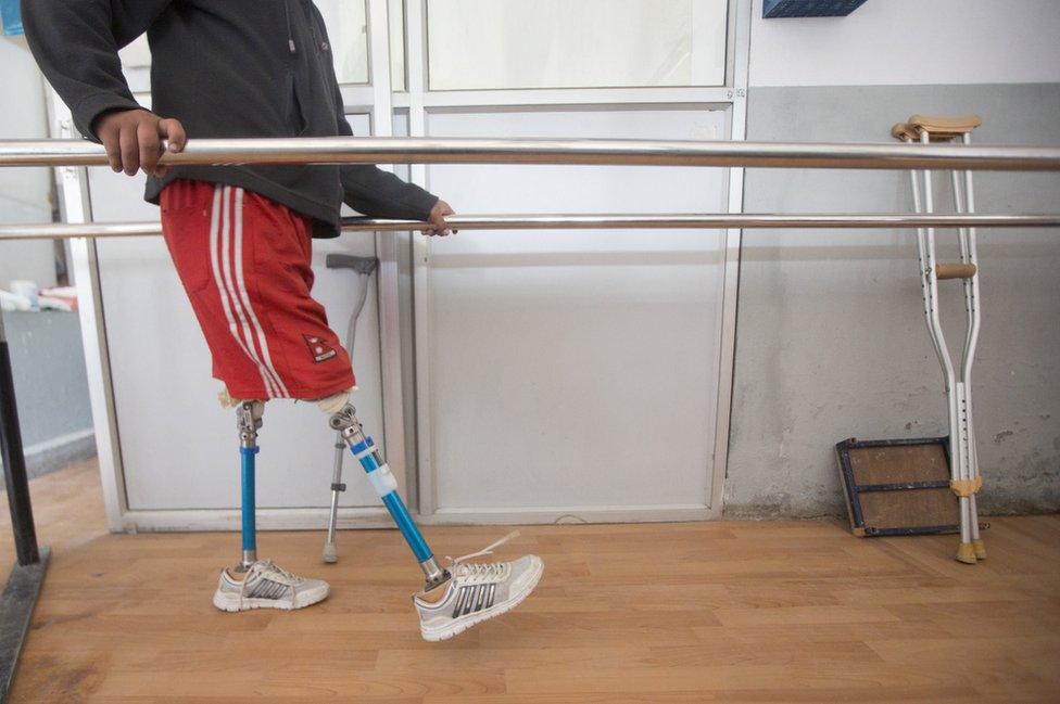 Ramesh uses the walkway within the National Disability Fund clinic in Kathmandu to train on his prosthetics