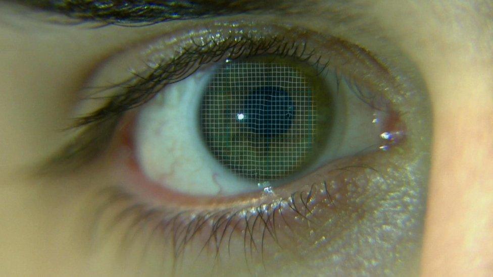 An eye being scanned