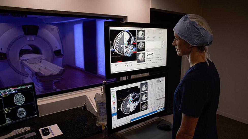 Tracking the path of the laser probe in the brain in an MRI