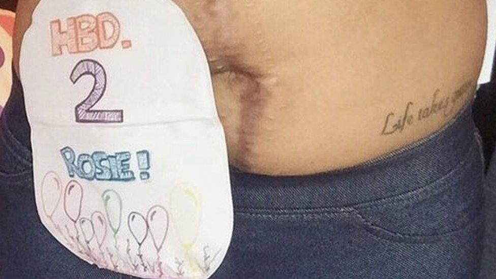 Stoma bag with drawn on pictures