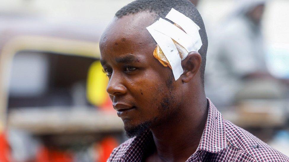 A Somali soldier, injured in a suicide bombing attack at a military base, is seen at the Madina Hospital in Mogadishu, Somalia June 15, 202