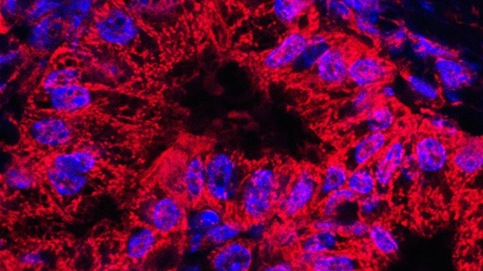 Microscopic image of mitochondrial stained pancreatic cancer cells