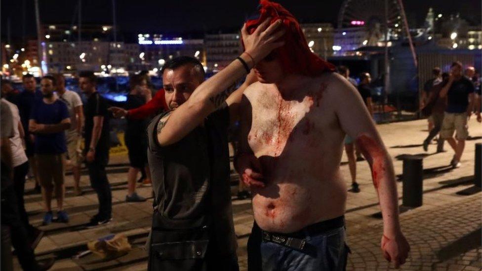 A football fan is helped after sustaining a head wound in Marseille