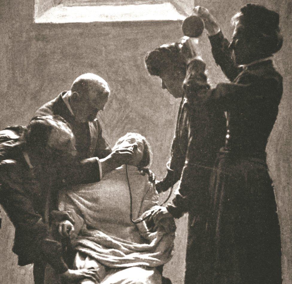 Suffragette being force fed with the nasal tube in Holloway Prison, London, 1909