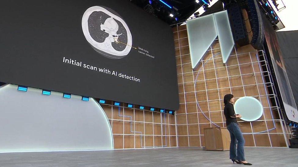 Google AI cancer announcement