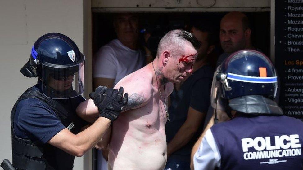 A bloodied fan being led away by police