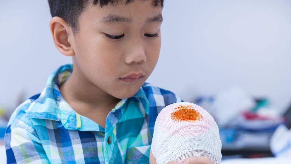 A boy looking at his injured knee