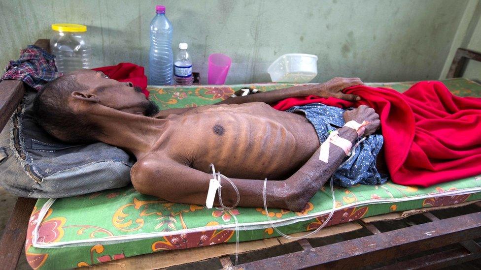 A prisoner, too weak to stand, lies in the prison infirmary at the National Penitentiary in downtown Port-au-Prince