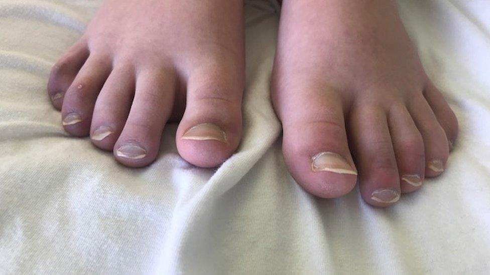 Sofia's toes