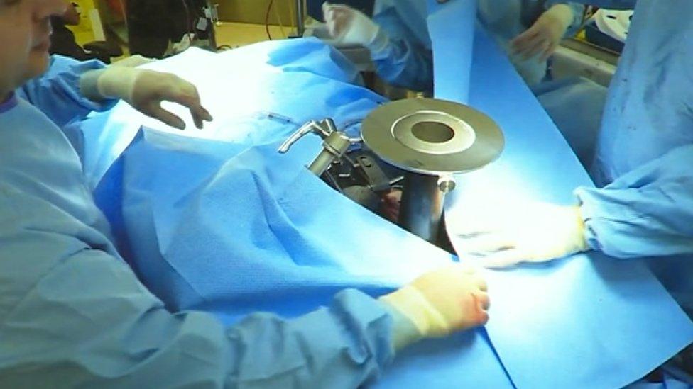 IORT surgery