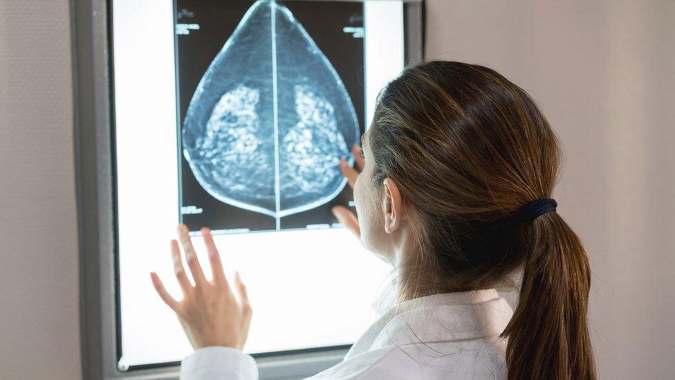 mammogram