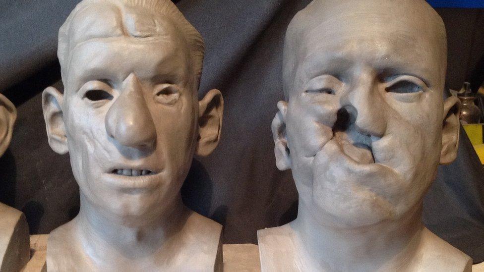 Sculptures of people with facial injuries