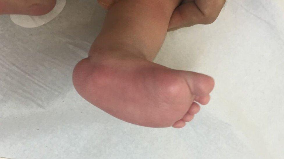 Baby's foot