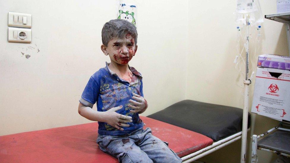 A Syrian boy awaits treatment at a make-shift hospital following air strikes on rebel-held eastern areas of Aleppo on September 24, 201