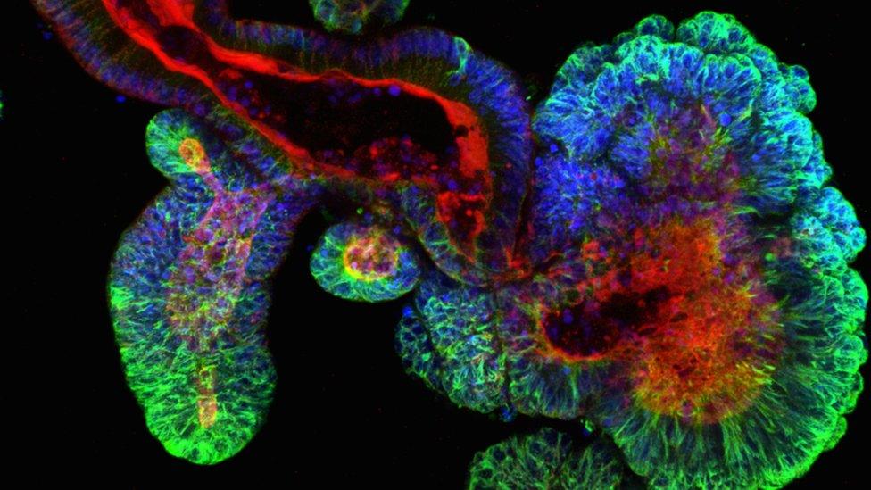 Intestinal organoid