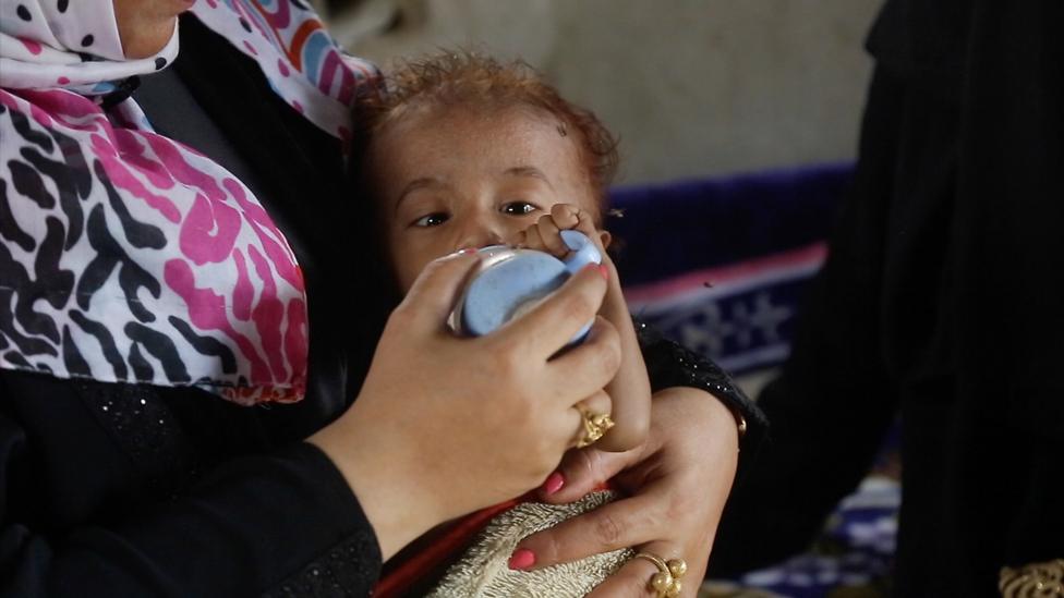 Abdulrahman receives bottle-milk