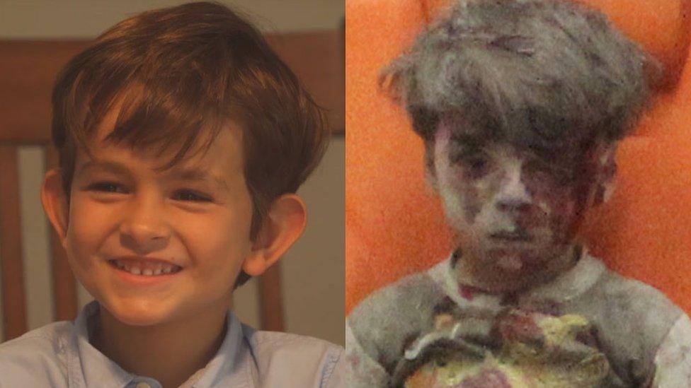 Alex, 6, from New York, and Omran, 5, from Syria, side-by-side in a composite image
