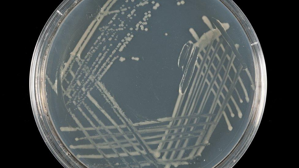 Bradyrhizobium growing on agar plates (Image: Rothamsted Research)