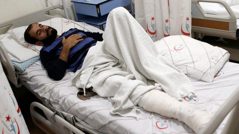 Saddam Haccar, a fighter of the Syrian opposition who was wounded during air strikes in Syria near Syrian-Turkish border, receives medical treatment at Kilis state hospital in Kilis, Turkey, 07 February 2016