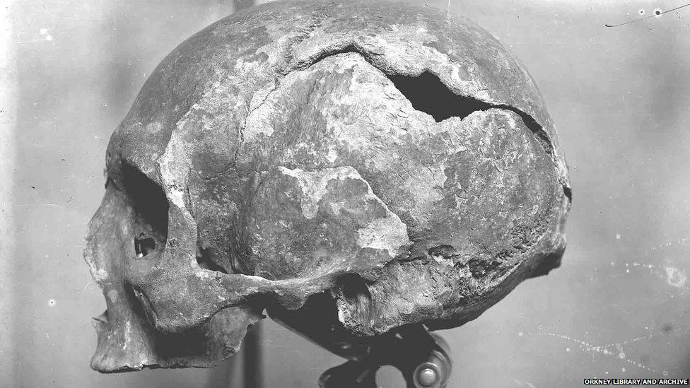 Tom Kent's picture of the skull