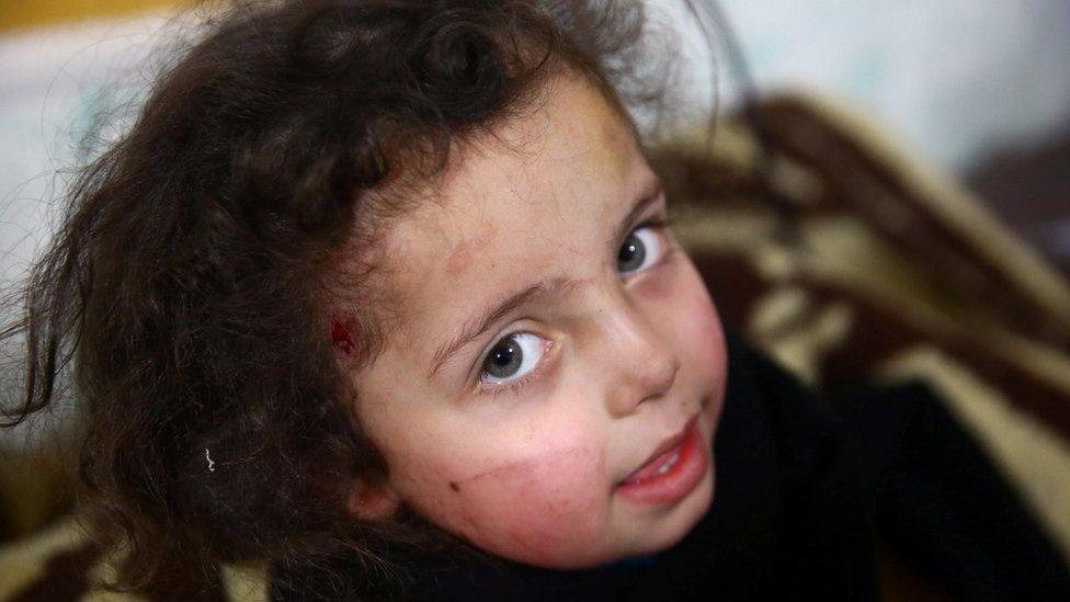 A wounded girl is seen in a hospital in the besieged town of Douma, Eastern Ghouta, Damascus, Syria, 23 February 2018