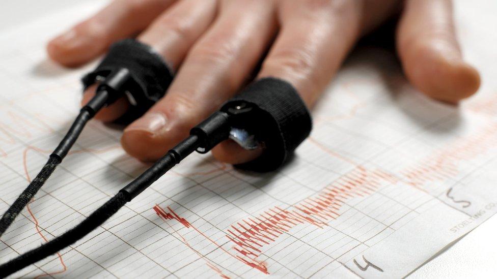 A man's hand shown during a polygraph test