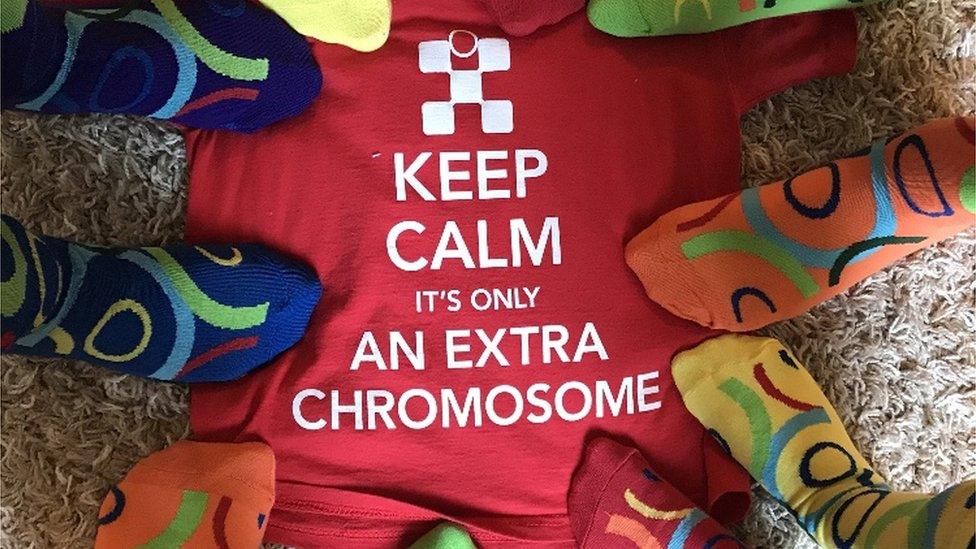 Socks on a Tshirt which says Keep calm it's only an extra chromosome